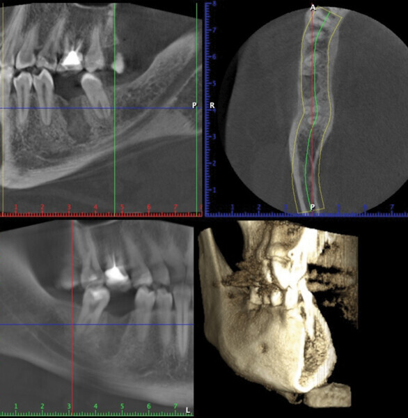 Fig. 10
