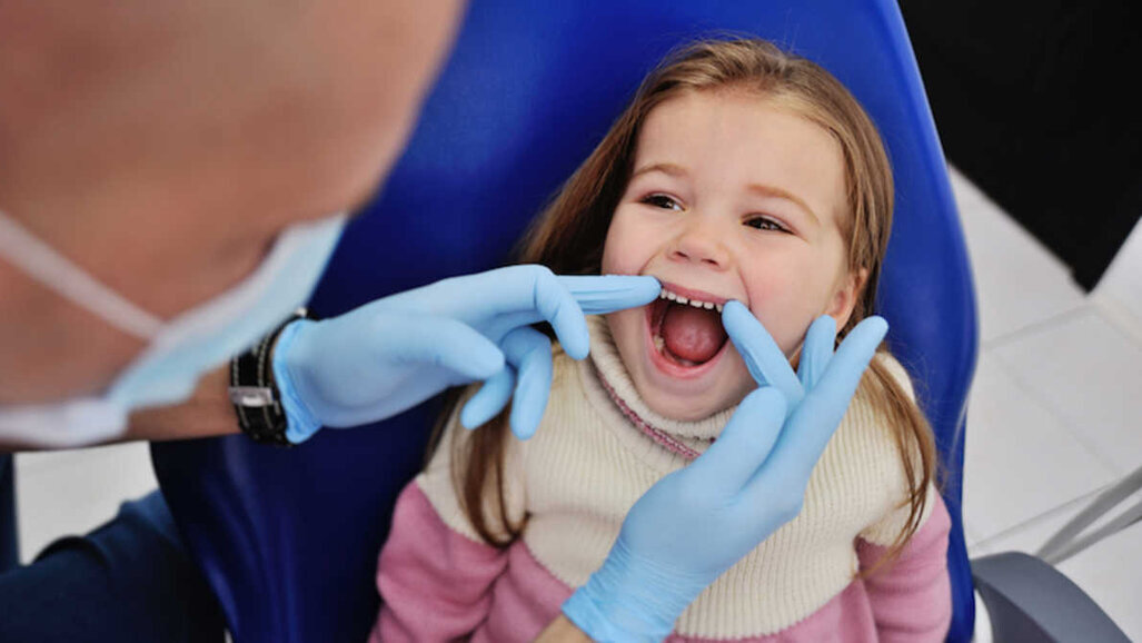 Studie zjistila, že výplně nemusí být nejlepší metodou ošetření dětského zubního kazu