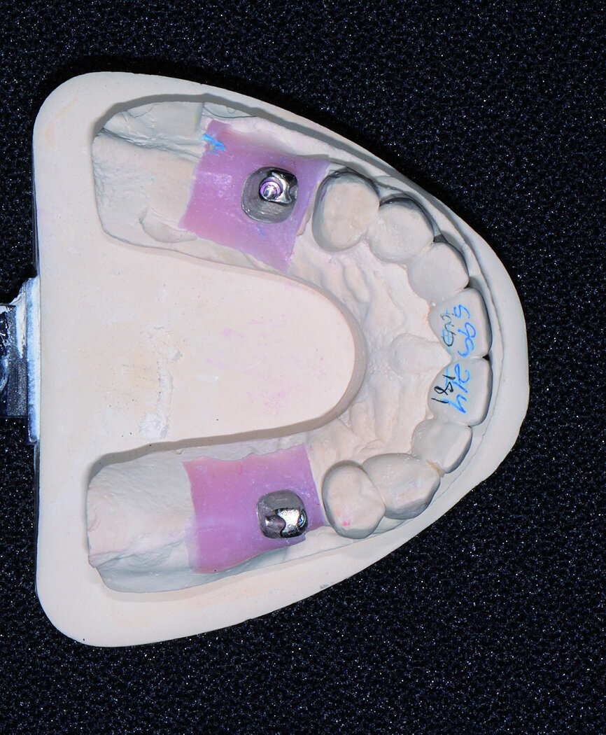 Fig. 15
