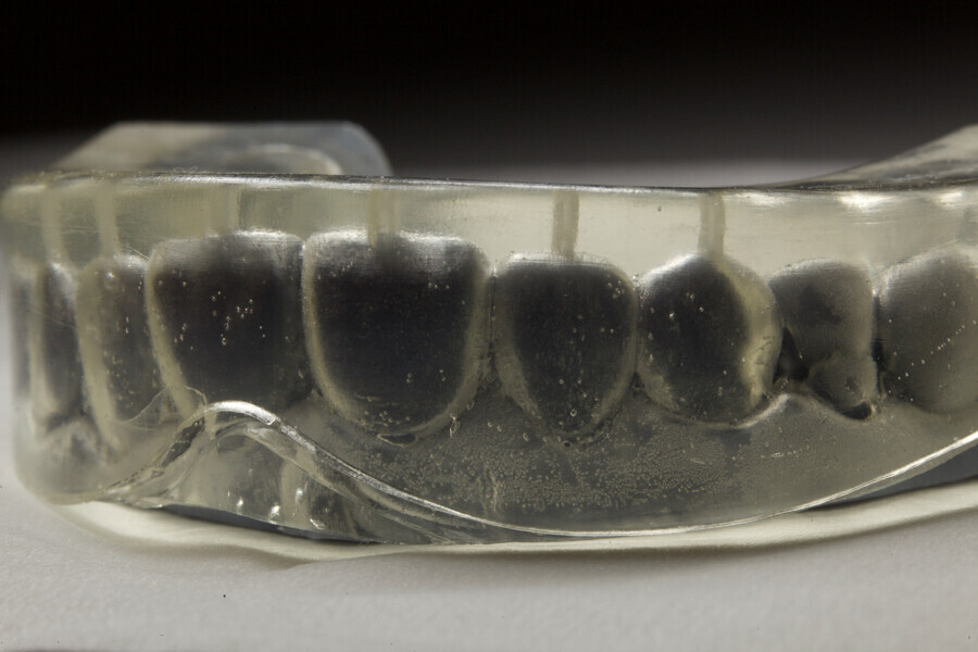 Fig. 7: Close-up view of the index with injection channels.