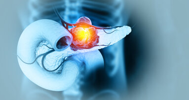 Natural tooth count associated with long-term survival after pancreatic cancer surgery