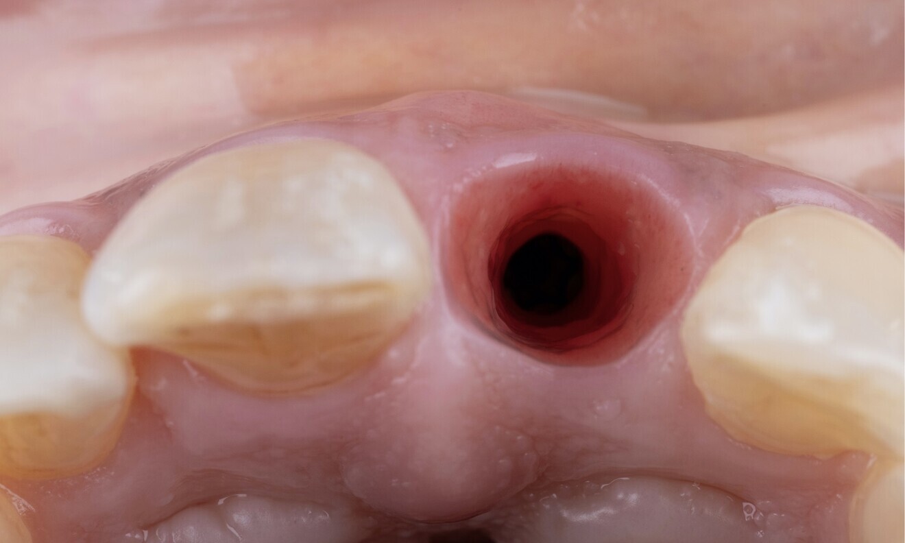 Fig. 9