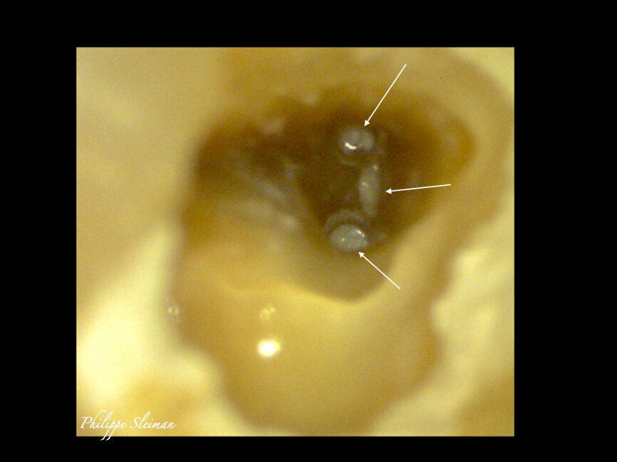 Fig. 14