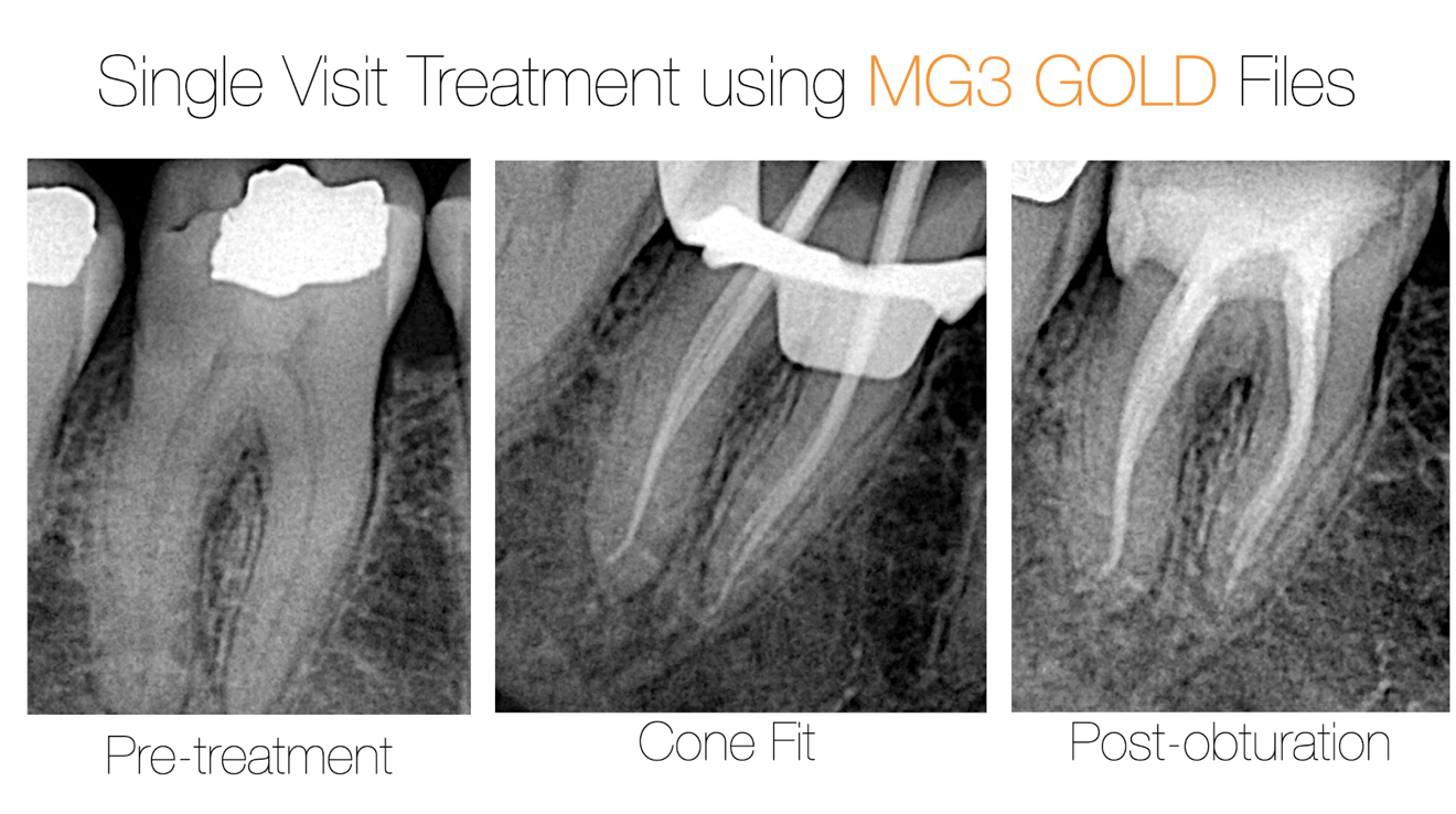 Fig. 10