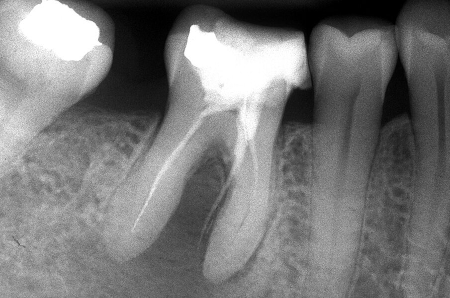 Fig. 3a