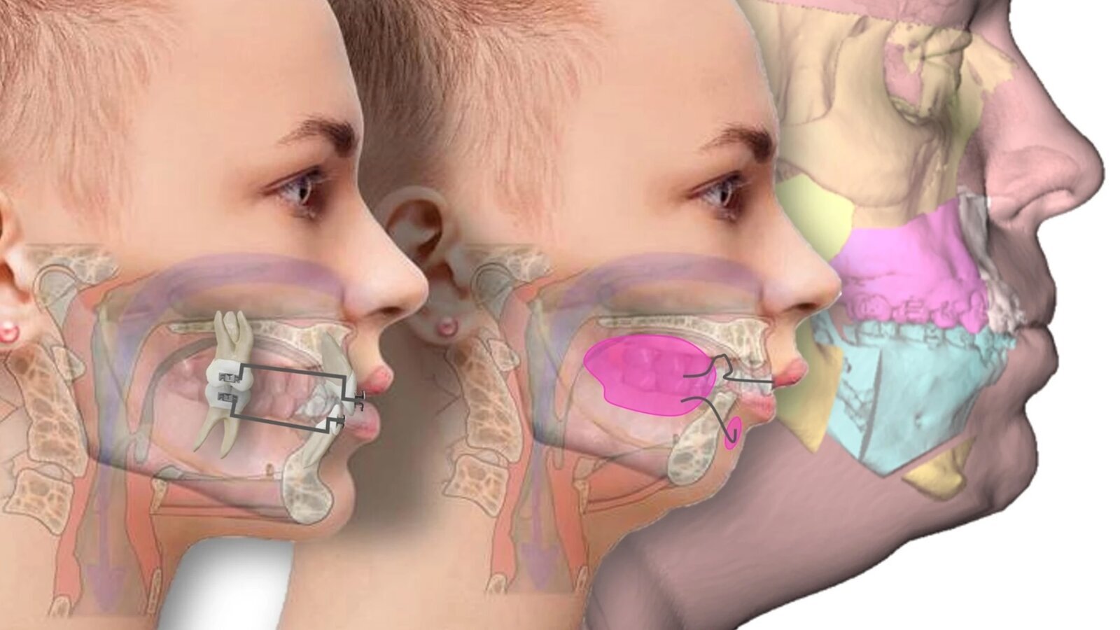 El enorme impacto de la Ortodoncia Médica