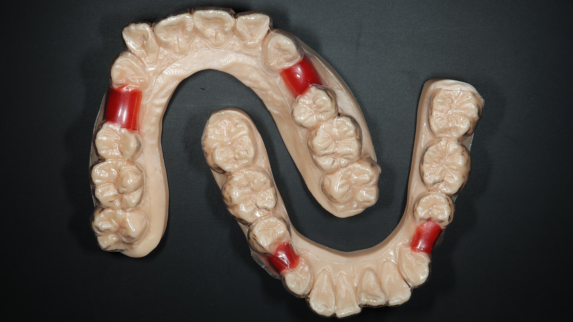 In-house 3D-printing workflows for implant restorations and Shape Memory Aligners