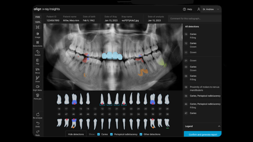 Align Technology introduces new software innovations designed to accelerate digital practice transformation