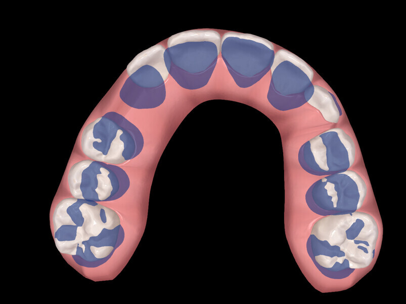 Fig. 18