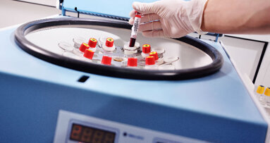 Prevenzione e cura delle osteonecrosi della ossa mascellari con concentrati piastrinici autologhi