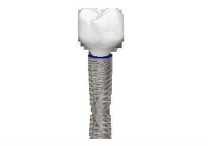 Aurea®