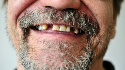 Two separate studies reveal exciting future in tooth bioengineering