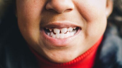 Cruciale rol voor ouders bij gezond houden kindergebitten