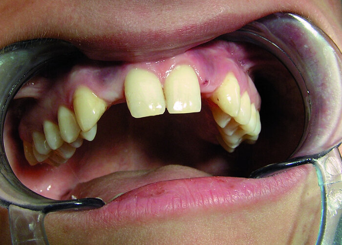 Figure 15a