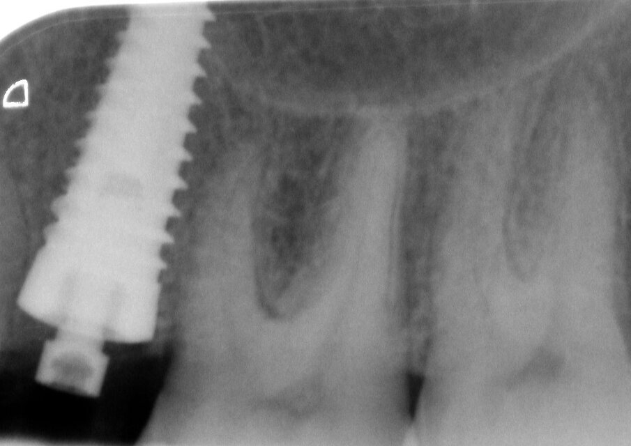 Fig. 12