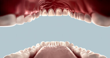 COVID-19 and the dental market: The pandemic continues to bite