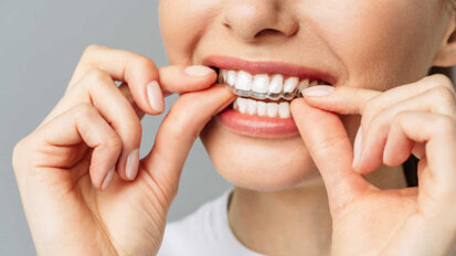 Nhiều cơ quan nha khoa chuyên nghiệp đạt được sự đồng thuận về chỉnh hình răng tự làm