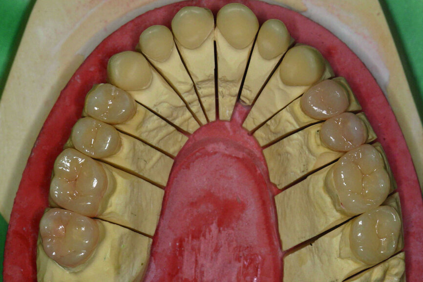 Fig.4