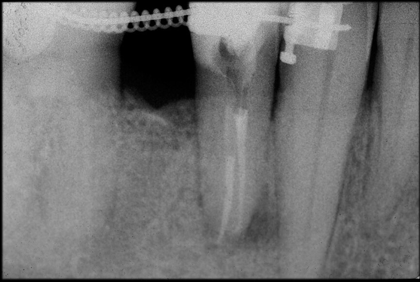 Fig. 9