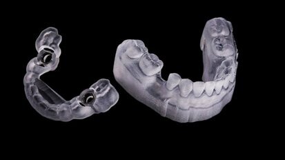 Digitalisation of the gold standard of implantology