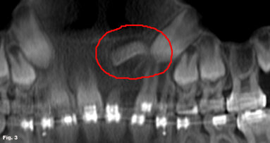 Straight talk on 3-D imaging from an orthodontist