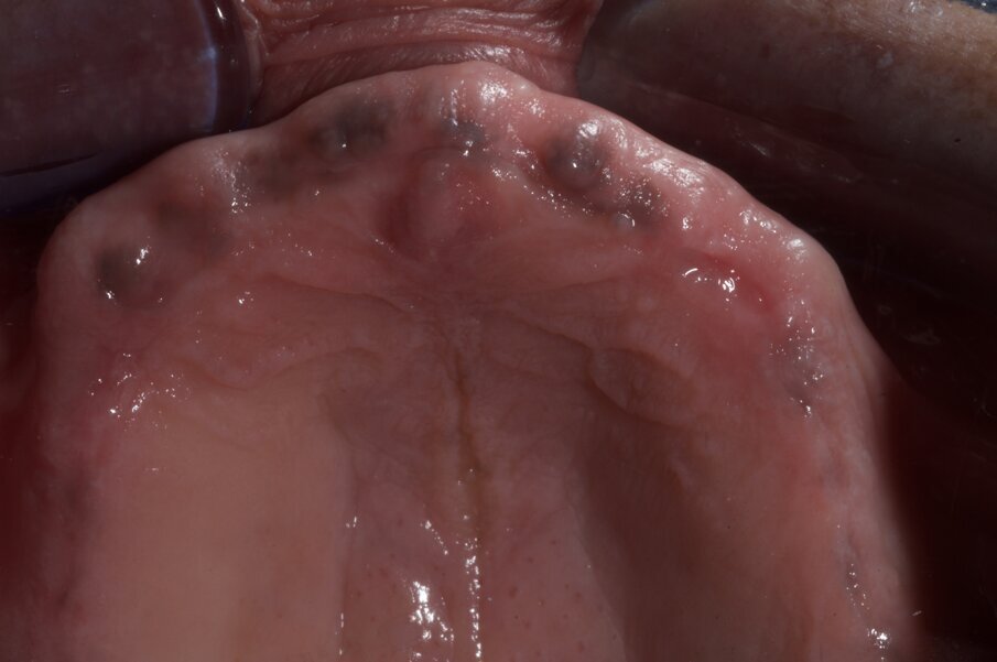 Fig. 9