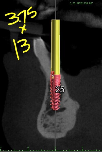 Fig. 5c