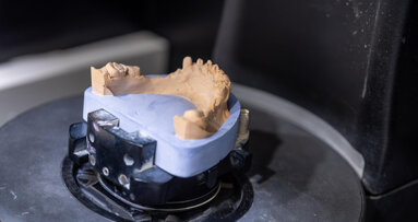 Fast-track smiles: USIM brings digital dentistry to community outreach with 3D-printed dentures