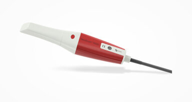 NeoScan 1000: Neuer, benutzerfreundlicher Intraoralscanner ab sofort im Handel erhältlich