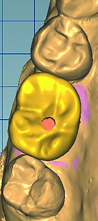 Fig. 15d