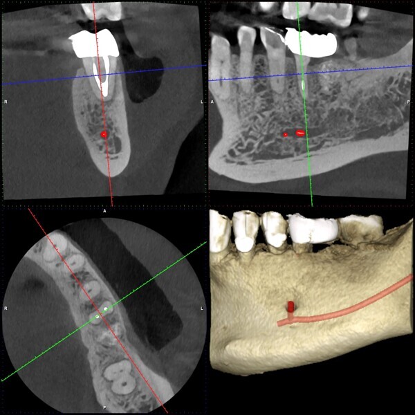 Fig. 16