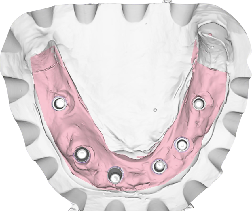 Fig. 12