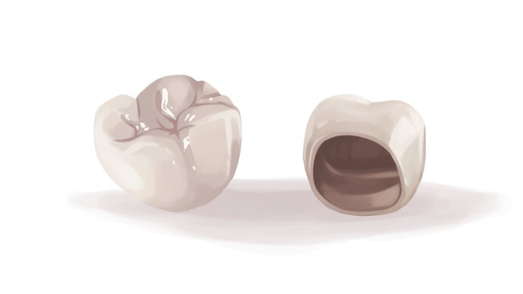 Alumina sandblasting - best method for zirconia surface cleaning & to improve its resin-bond strength