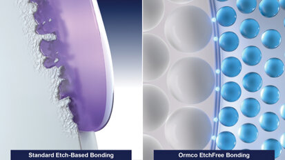 Ormco EtchFree Bonding system: Introducing the next generation of bonding, inspired by nature
