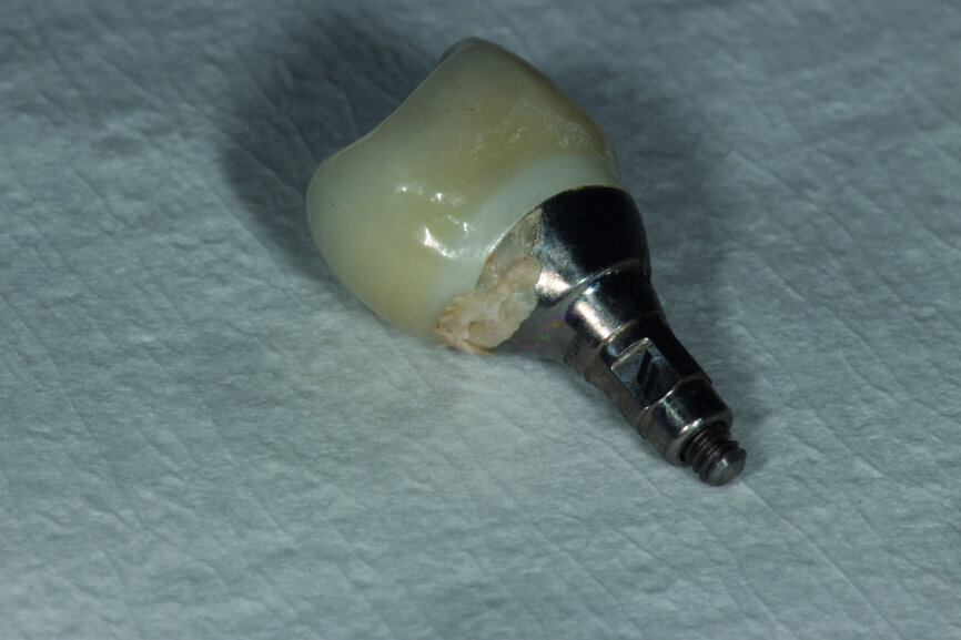 Fig. 3