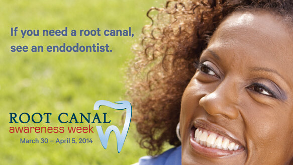 Fewer Americans fear root canals, more want to keep their natural teeth