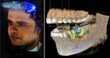 CFAO et facteurs de croissance — Domaines clés de l’innovation en odontologie