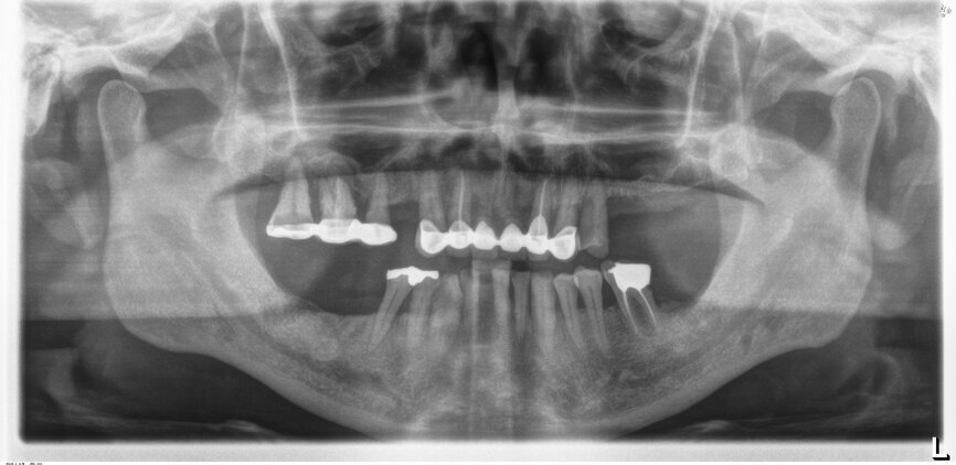 Fig. 2