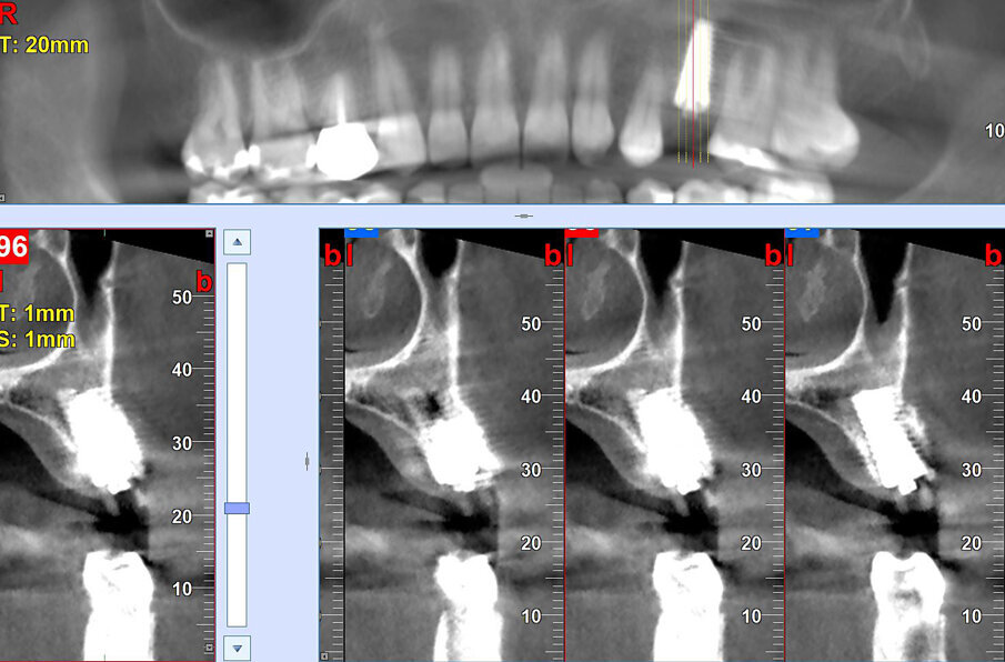 Fig. 15