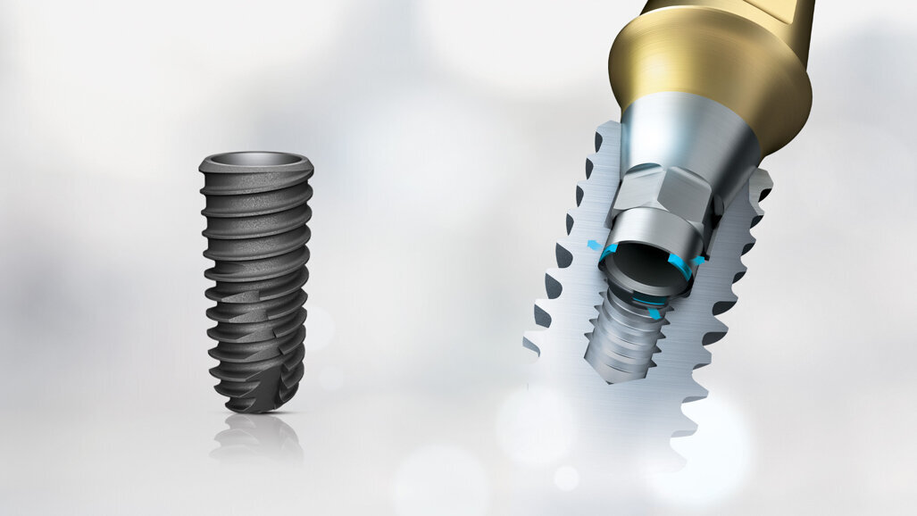 KS system: Key solution for strong dental implants