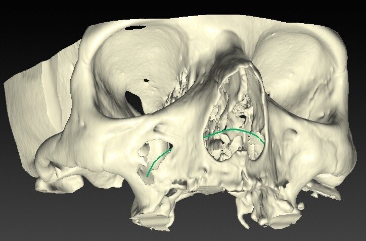 Fig. 1a