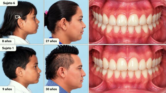 INVESTIGACIÓN Un atlas para entender cómo crecen los rostros de Latinoamérica