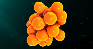 Researchers develop novel cytokine indices that reflect severity of periodontal inflammation
