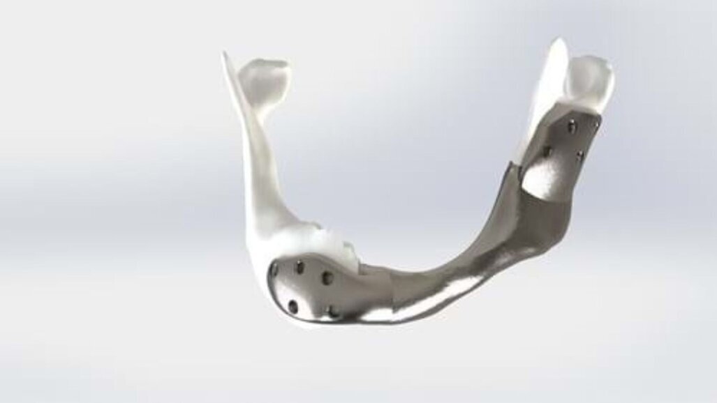 Antoni van Leeuwenhoek plaatst 3D-geprinte onderkaak