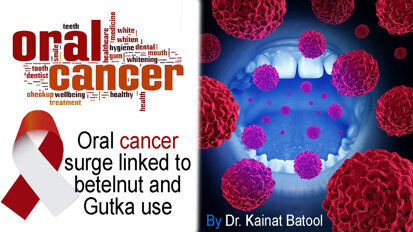 Oral cancer surge linked to betelnut and Gutka use