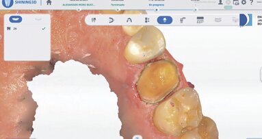 Estética y blanqueamiento dental en la era digital  (Capítulo 21)