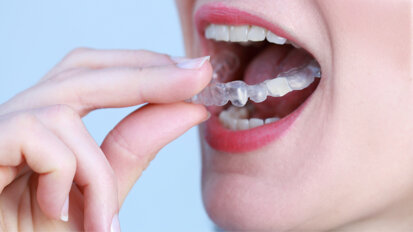 Digital splints may improve bruxism management