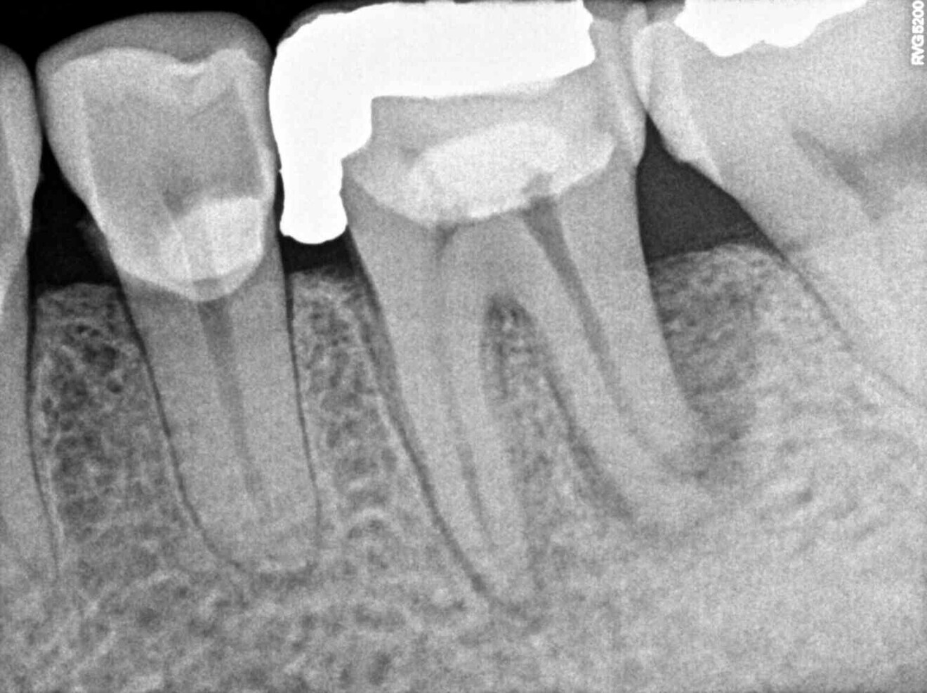 Fig. 1a