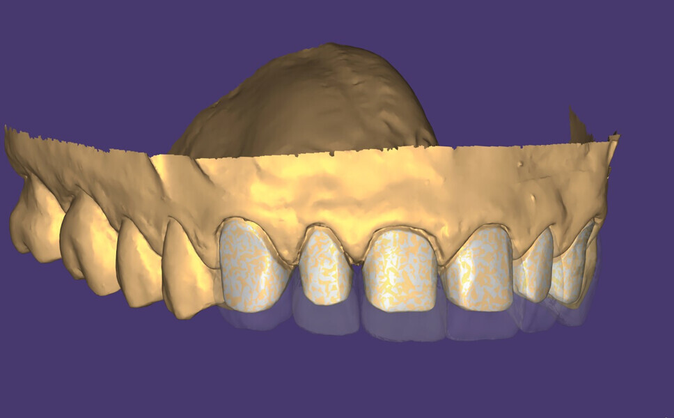 Fig. 12: Thickness control.