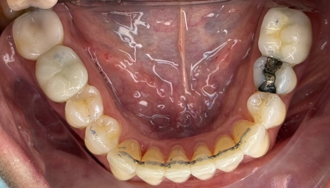 Fig. 6d